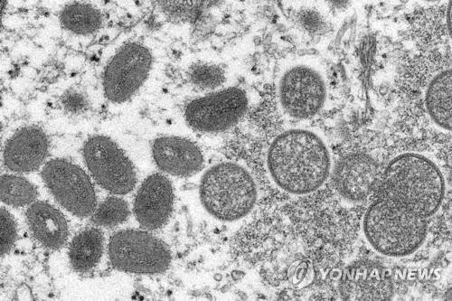 엠폭스(MPOX·원숭이두창) 바이러스 입자 [AP 연합뉴스 자료사진. 재판매 및 DB 금지]