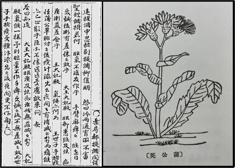&lt;승정원일기&gt; 영조 1년 을사(1725) 9월 29일자에는 효장세자의 생인손에 민들레를 붙여 치료했다는 내용이 나온다. 우측은 &lt;본초강목&gt;에 그려진 포공영(민들레) 그림이다.
