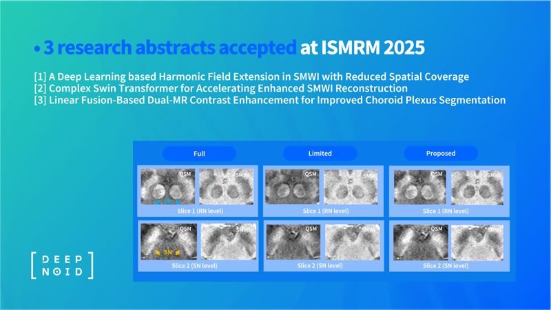 ISMRM 2025 연구 초록 채택 이미지. 딥노이드 제공.