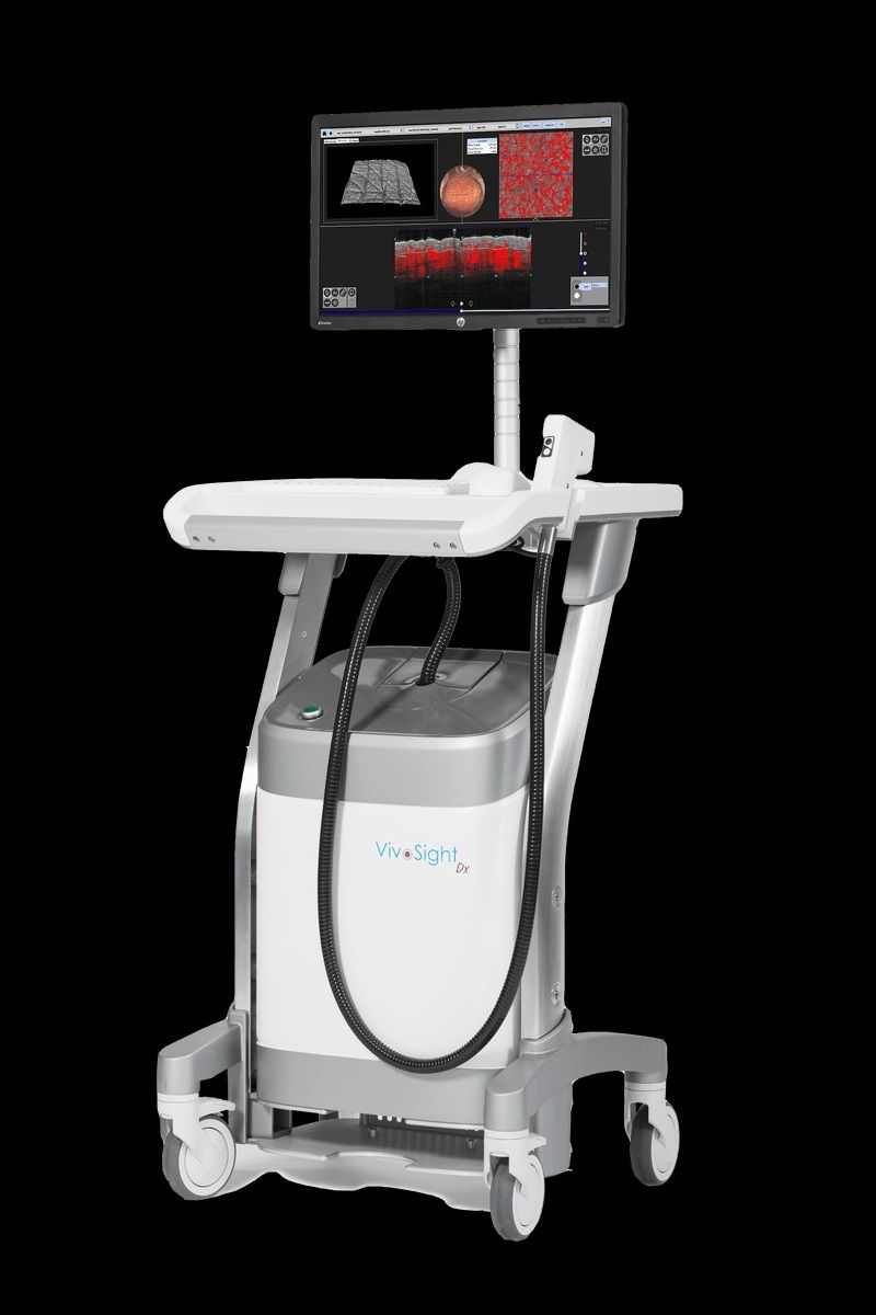 <span id='_stock_code_347740' data-stockcode='347740'>피엔케이피부임상연구센타</span>가 도입한 OCT 장비. P&K 제공