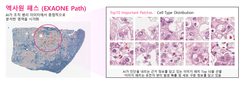 LG AI연구원이 개발한 엑사원 패스의 암 유전자 변이 예측 이미지. LG AI연구원 제공