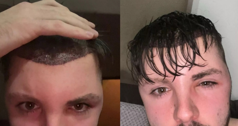 /사진=바이스 갈무리