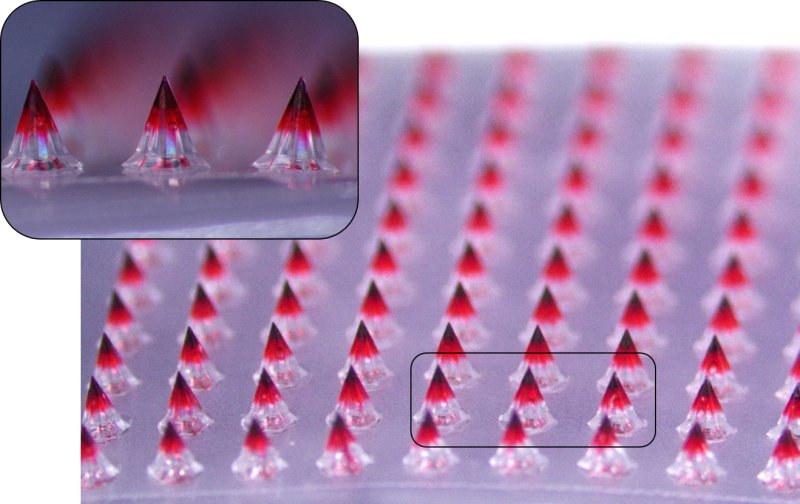 <span id='_stock_code_003090' data-stockcode='003090'>대웅</span>테라퓨틱스가 개발한 마이크로니들 패치의 약물층을 시각적으로 표현하기 위해 색소를 첨가하고 6.7배 확대 촬영한 모습. <span id='_stock_code_069620' data-stockcode='069620'>대웅제약</span> 제공