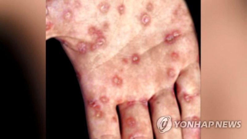 (출처=연합뉴스)