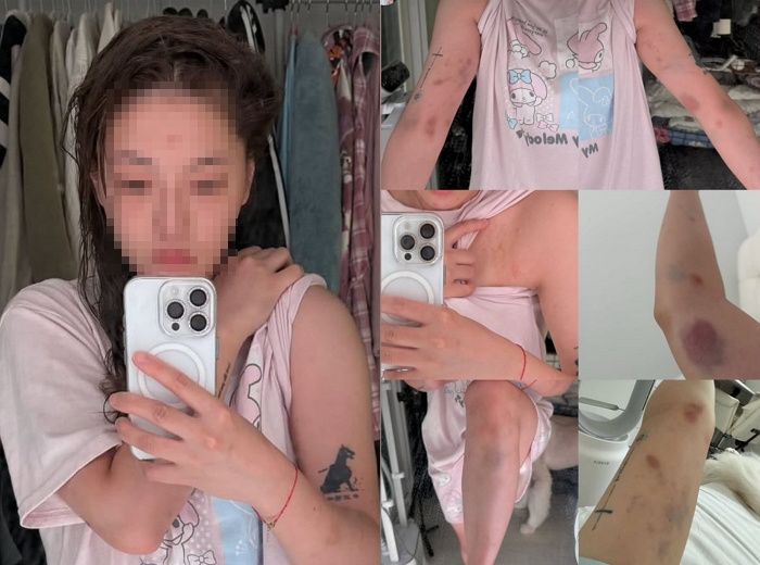 서울 도심에서 대만인 여성이 한국인 <span id='_stock_code_004270' data-stockcode='004270'>남성</span>들한테 폭행당한 사건이 발생했다.&#x2F;사진&#x3D;A씨 SNS 캡처