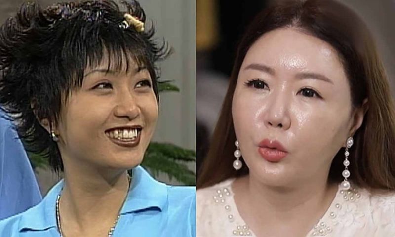 배우 이의정의 과거 모습(왼쪽)과 현재 모습.&#x2F;MBC 시트콤 ‘남자 셋 여자 셋’, MBN ‘명을 사수하는 사람들 명사수’