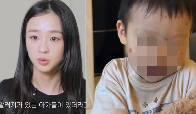 전 리듬체조 국가대표 손연재가 아들의 심한 모기 알레르기 증상을 털어놨다. 사진&#x3D;유튜브 채널 &#39;손연재&#39;, 뉴시스