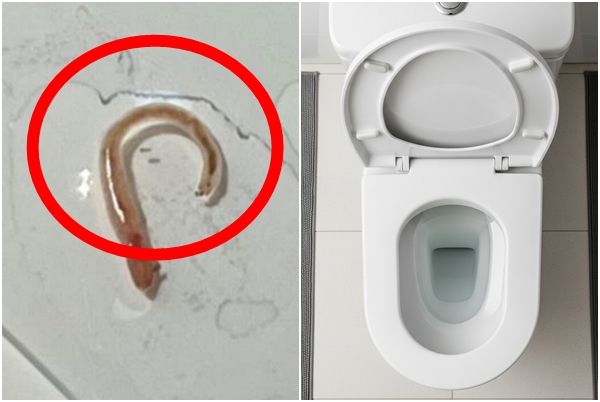 중국 58세 여성이 자신의 소변에서 배출된 기생충이라고 의심했던 벌레. 결국 토양에서 유래한 지렁이인 것으로 확인됐다./사진=임상사례보고저널