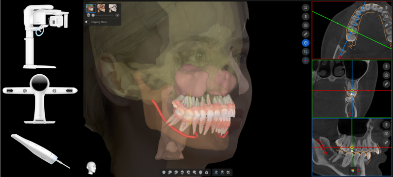 <span id='_stock_code_228670' data-stockcode='228670'>레이</span> 5D 신기술 이미지. 레이 제공