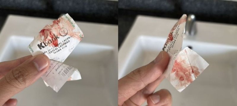 태국 방콕의 지하철(MRT) 열차 안에서 정체불명의 남성이 승객의 팔에 피를 문지른 사건이 발생해 현지에서 우려가 커지고 있다.2025.12.12.(사진=태국 더타이거 캡처) *재판매 및 <span id='_stock_code_012030' data-stockcode='012030'>DB</span> 금지 /사진=뉴시스