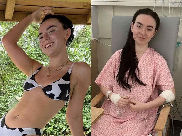 반복되는 복통과 혈변을 단순 치질로 여겼다가, "48시간 안에 수술하지 않으면 사망할 수 있다"는 진단을 받고 응급 장 절제 수술을 받은 20대 여성의 사연이 전해졌다./사진=니드 투 노우